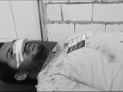 पलामू में रिश्तेदार ने काट दी युवक की नाक | पलामू में अंबाला में युवाओं का अनोखा मामला: पत्नी के साथ अवैध संबंध का था शक, मॉल के पास युवाओं पर हमला - पलामू समाचार