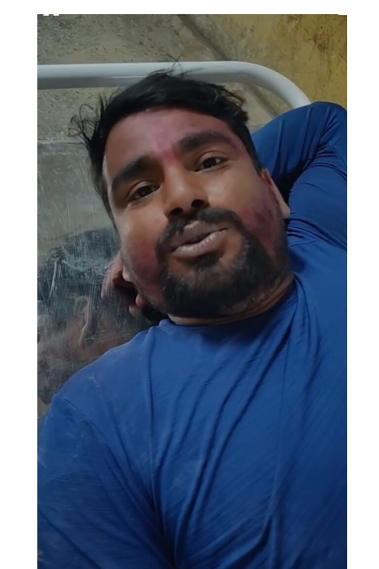 होली के जश्न में चली गोलियां: बरमसिया फुटबॉल ग्राउंड में फायरिंग, दो युवक घायल